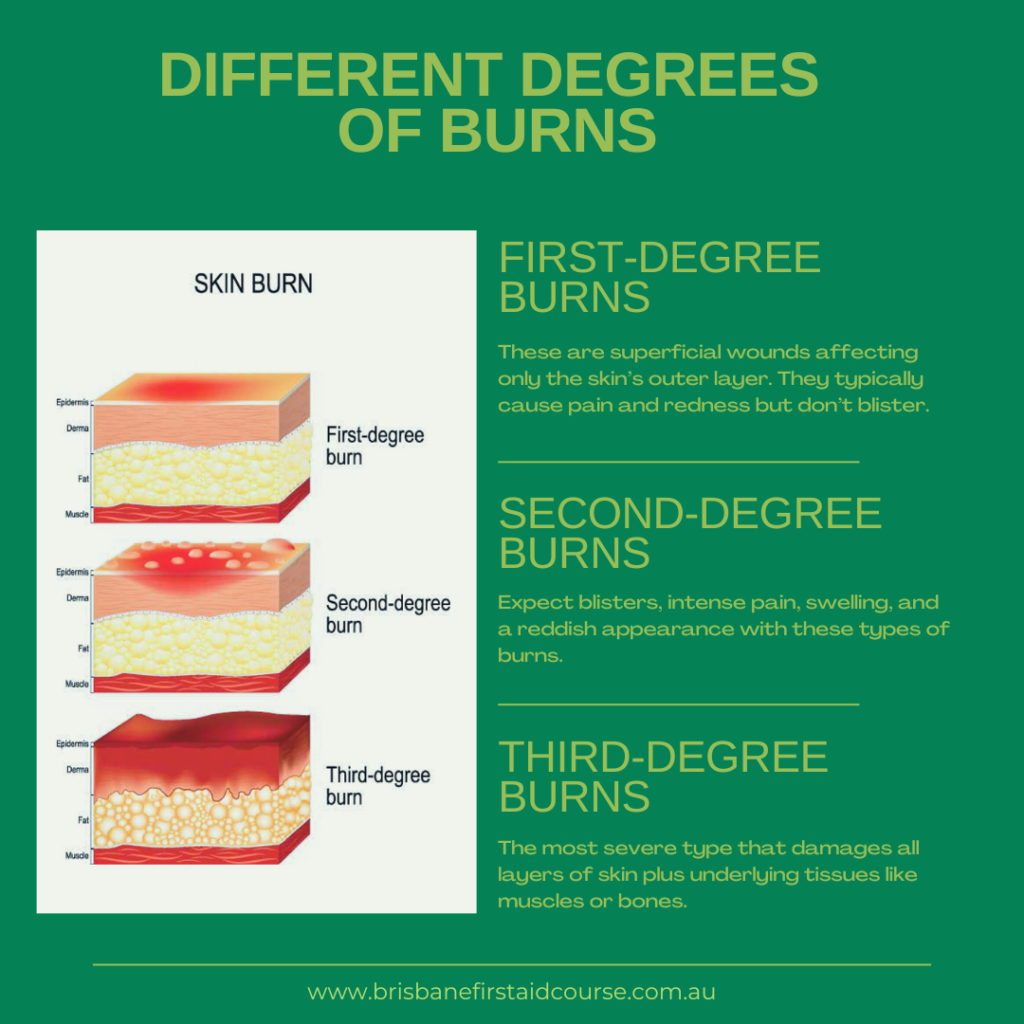 Different Degrees of Burns